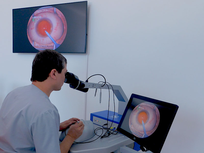 KESH MEDICAL PLAZA ko`z jarroxlik amaliyoti o`tkaziladi